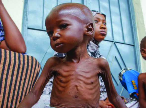 Millions in Somalia on brink of worsening hunger as WFP faces critical funding shortfall